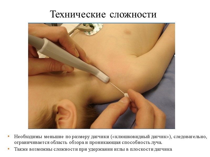 Технические сложности Необходимы меньшие по размеру датчики («клюшковидный датчик»), следовательно, ограничивается область обзора и